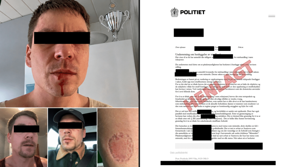 HENLAGT: Bildene viser et lite utvalg av foto- og videobevisene som «Fredrik» la ved da han anmeldte kona for vold. Til høyre: Politiets underretning om at saken ble henlagt etter bevisets stilling.